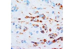 Image no. 1 for anti-Junction Plakoglobin (JUP) (N-Term) antibody (ABIN1494121) (JUP antibody  (N-Term))