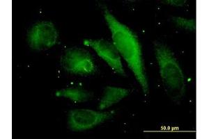 Image no. 3 for anti-Microtubule-Associated Protein, RP/EB Family, Member 2 (MAPRE2) (AA 1-63) antibody (ABIN466174) (MAPRE2 antibody  (AA 1-63))