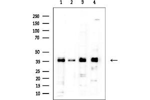 anti-Heterogeneous Nuclear Ribonucleoprotein C (C1/C2) (HNRNPC) (C-Term) antibody