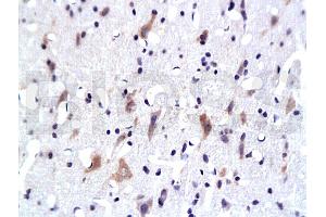 Formalin-fixed and paraffin embedded: rat brain tissue labeled with Anti-PKB Polyclonal Antibody, Unconjugated 1:200 followed by conjugation to the secondary antibody and DAB staining (AKT1/3 (AA 401-479) antibody)
