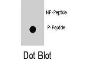 Dot blot analysis of ZBTB16 (phospho Y334) polyclonal antibody  on nitrocellulose membrane. (ZBTB16 antibody  (pTyr334))