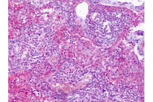 Anti-S1PR4 / EDG6 antibody IHC of human lymph node. (S1PR4 antibody  (Cytoplasmic Domain))