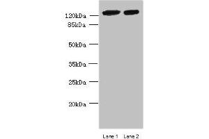 Western blot All lanes: MCM9 antibody at 0.