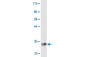 Western Blot detection against Immunogen (32. (EHD2 antibody  (AA 365-427))