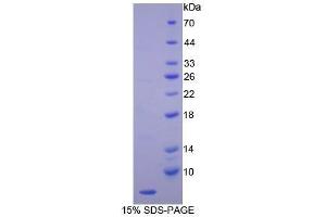 SDS-PAGE (SDS) image for Endothelin 1 (EDN1) (AA 53-90) protein (His tag) (ABIN1079398)