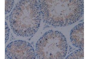 #VALUE! (CX3CL1 antibody  (AA 83-330))
