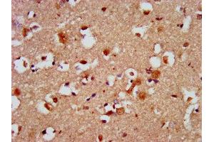 IHC image of ABIN7146458 diluted at 1:500 and staining in paraffin-embedded human brain tissue performed on a Leica BondTM system.