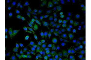 SMMC7721 cells were stained with ARMC3 Polyclonal Antibody, Unconjugated  at 1:50 in PBS and incubated for one hour at room temperature, followed by secondary antibody incubation, DAPI staining of the nuclei and detection. (ARMC3 antibody  (AA 752-840))