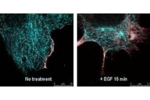 Immunofluorescence (IF) image for anti-V-Akt Murine Thymoma Viral Oncogene Homolog 1 (AKT1) (Ser473) antibody (ABIN400784) (AKT1 antibody  (Ser473))