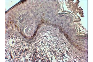 ABIN768626 (2µg/ml) staining of paraffin embedded Human Skin. (CMA1 antibody  (Internal Region))
