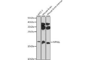 Western blot analysis of extracts of various cell lines, using NRN1L antibody (ABIN7268861) at 1:1000 dilution. (Neuritin 1-Like antibody)
