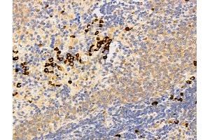 ABIN7094787 and ABIN7098838 at 1/100 staining Rat spleen tissue by IHC-P. (DCP2 antibody  (Internal Region))