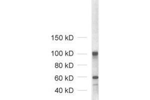 Western Blotting (WB) image for anti-Neuroligin 1/2/3/4 (NLGN1/2/3/4) (AA 1-695) antibody (ABIN1742285) (Neuroligin 1/2/3/4 antibody  (AA 1-695))