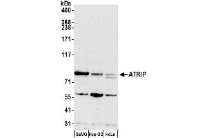 Western Blotting (WB) image for anti-ATR Interacting Protein (ATRIP) (AA 100-150) antibody (ABIN7453575)