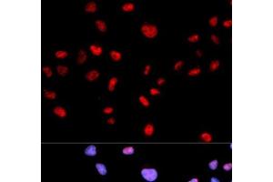 Immunofluorescence analysis of MCF-7 cells using Phospho-CDK1(T161) Polyclonal Antibody (CDK1 antibody  (pThr161))