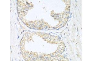 Immunohistochemistry of paraffin-embedded Human prostate using SGCB Polyclonal Antibody at dilution of 1:100 (40x lens). (SGCB antibody)