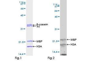 Kinase Activity Assay (KAA) image for Feline Sarcoma Oncogene (FES) (AA 1-822) protein (GST tag) (ABIN1353967)