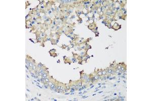 Immunohistochemistry of paraffin-embedded human prostate using NEDD4L antibody.