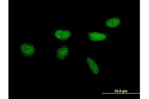 Immunofluorescence of purified MaxPab antibody to XPA on HeLa cell. (XPA antibody  (AA 1-273))