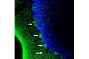 Expression of GPR40/FFAR1 in rat brainImmunohistochemical staining of rat brain sections using Anti-GPR40/FFAR1 (extracellular) Antibody (ABIN7043137, ABIN7044279 and ABIN7044280). (Free Fatty Acid Receptor 1 (FFAR1) Peptide)