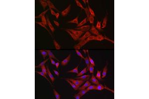 Immunofluorescence analysis of NIH/3T3 cells using R Rabbit pAb (ABIN6132924, ABIN6146720, ABIN6146721 and ABIN6214772) at dilution of 1:100 (40x lens). (RASGRP1 antibody  (AA 598-797))
