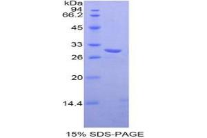 SDS-PAGE analysis of Mouse TXK Tyrosine Kinase Protein.