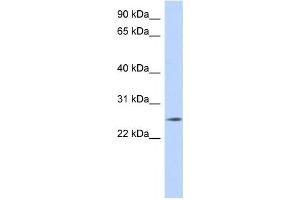 Western Blotting (WB) image for anti-Na+/K+ Transporting ATPase Interacting 4 (NKAIN4) antibody (ABIN2459631)