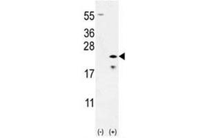 Western blot analysis of Bax antibody and 293 cell lysate (2 ug/lane) either nontransfected (Lane 1) or transiently transfected (2) with the Bax gene.