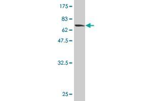 Western Blot detection against Immunogen (65. (HMBS antibody  (AA 1-361))