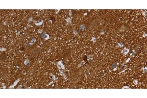 Immunohistochemistry of paraffin-embedded Human brain using SNCG Polyclonal Antibody at dilution of 1:60 (SNCG antibody)