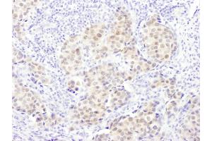 anti-Proteasome (Prosome, Macropain) Subunit, beta Type, 5 (PSMB5) (AA 213-263) antibody