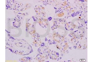 Formalin-fixed and paraffin embedded human placenta labeled with Anti-ADFP Polyclonal Antibody, Unconjugated (ABIN738606) at 1:200 followed by conjugation to the secondary antibody and DAB staining. (ADRP antibody  (AA 31-130))