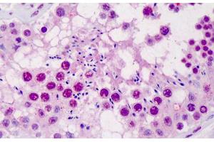 Human Testis: Formalin-Fixed, Paraffin-Embedded (FFPE) (SCML1 antibody  (AA 3-101))