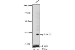 Western blot analysis of extracts of HeLa cells, using Phospho-IκBα-S32 antibody (ABIN6135267, ABIN6136154, ABIN6136155 and ABIN6225645) at 1:1000 dilution. (NFKBIA antibody  (pSer32))