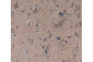 Used in DAB staining on fromalin fixed paraffin- embedded Kidney tissue (Basonuclin 1 antibody  (AA 43-246))