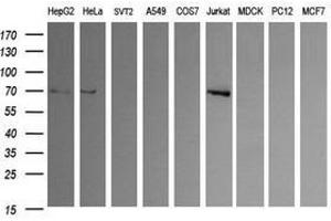 Image no. 2 for anti-Endoglin (ENG) antibody (ABIN1497150) (Endoglin antibody)