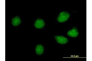 Immunofluorescence of purified MaxPab antibody to CREB3L1 on HeLa cell. (CREB3L1 antibody  (AA 1-519))