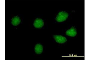Immunofluorescence of purified MaxPab antibody to CREB3L1 on HeLa cell.