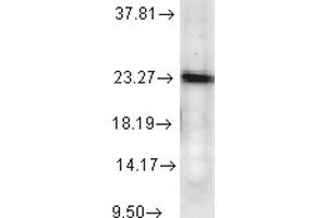 CDK5R1 Antikörper  (FITC)