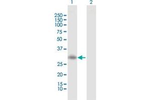 Western Blot analysis of RGS20 expression in transfected 293T cell line by RGS20 MaxPab polyclonal antibody. (RGS20 antibody  (AA 1-241))