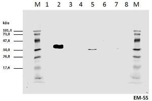 Cell lyzates of HEK293T/17 cells transiently transfected with expression vectors harboring genes for mCD3zeta wild type and six different mCD3zeta mutants, where particular ITAM tyrosines were substituted with phenylalanines, were prepared. (CD247 antibody  (pTyr111, pTyr123))