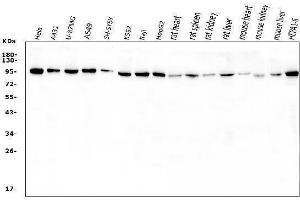 Western blot analysis of VCP using anti-VCP antibody (ABIN3043958). (VCP antibody  (C-Term))