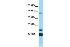 Host: Rabbit Target Name: CAMSAP3 Sample Type: ACHN Whole Cell lysates Antibody Dilution: 1. (CAMSAP3 antibody  (C-Term))