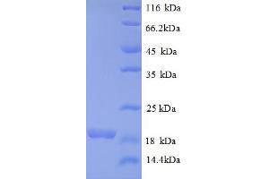 SDS-PAGE (SDS) image for Bone Morphogenetic Protein 6 (BMP6) (AA 382-513), (partial) protein (His tag) (ABIN5712750) (BMP6 Protein (AA 382-513, partial) (His tag))