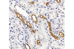 Immunohistochemistry analysis of paraffin-embedded rat kidney using,SLC12A1 (ABIN7075651) at dilution of 1: 2000 (SLC12A1 antibody)