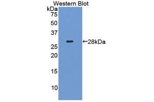 Western Blotting (WB) image for anti-Collagen, Type IV, alpha 2 (COL4A2) (AA 1487-1703) antibody (ABIN1858458) (COL4a2 antibody  (AA 1487-1703))
