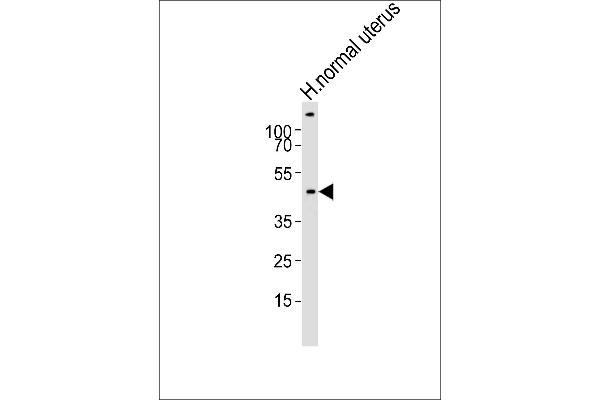 CERKL antibody  (N-Term)