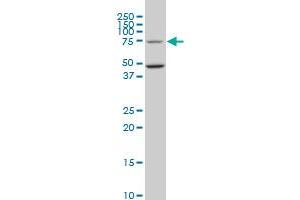 HSGT1 monoclonal antibody (M02), clone 1E5. (ECD/SGT1 antibody  (AA 1-644))