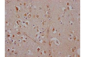 IHC image of ABIN7127325 diluted at 1:100 and staining in paraffin-embedded human brain tissue performed on a Leica BondTM system. (Recombinant ADORA1 antibody)
