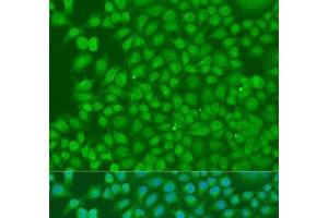 Immunofluorescence analysis of U2OS cells using BIRC3 Polyclonal Antibody at dilution of 1:100. (BIRC3 antibody)
